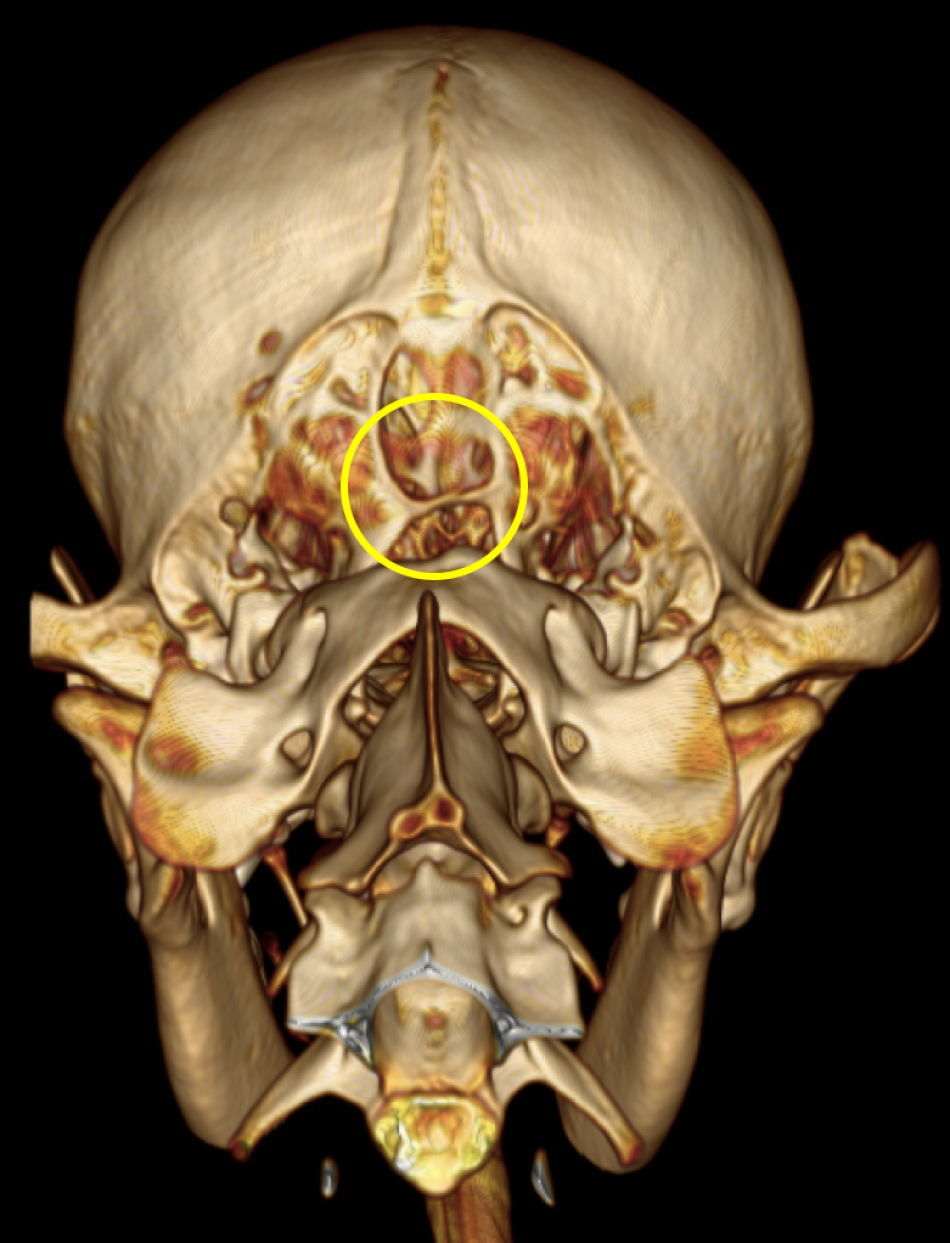 一般外科症例 東京都中野区で評判の動物病院 もみじ山通りペットクリニック 年中無休 予約優先制 一般外科症例 東京都中野区で評判の動物病院 もみじ山通りペットクリニック 年中無休 予約優先制